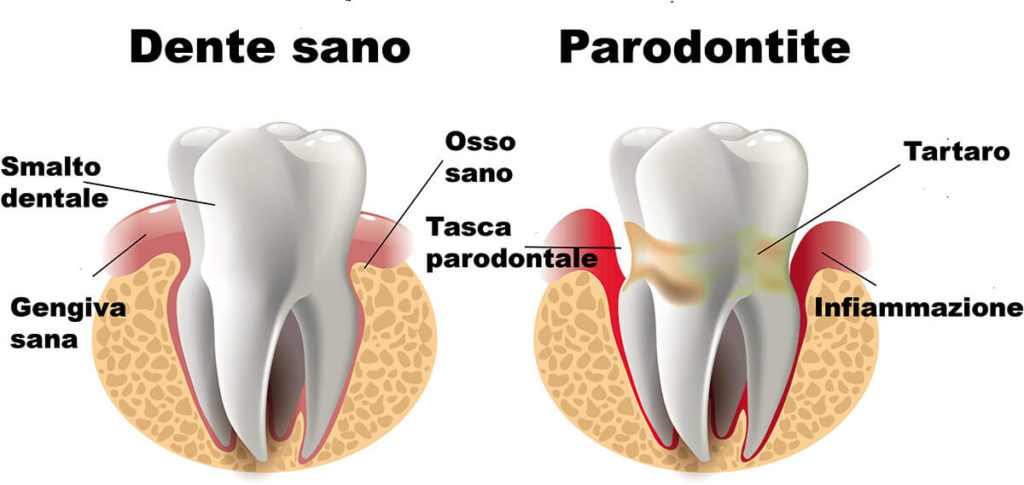 https://osmoz.al/wp-content/uploads/2020/01/parodontologia_it-1024x485-1.jpg